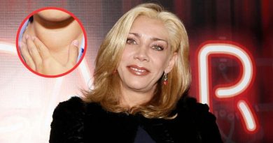 ¿QUÉ ES HASHIMOTO, ENFERMEDAD INCURABLE QUE PADECE CYNTHIA KLITBO?