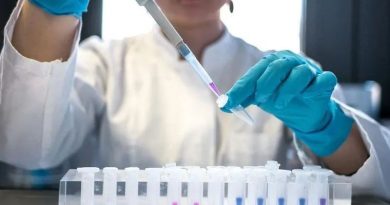 SIN CASOS DE ÉBOLA Y HANTAVIRUS EN MÉXICO, PERO HAY CAPACIDAD PARA DETECTAR POSIBLES CONTAGIOS, ASEGURA SECRETARÍA DE SALUD