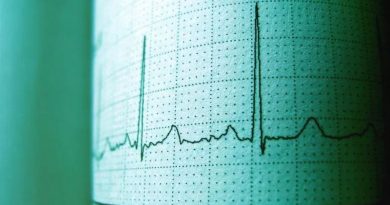POTENTE TERREMOTO DE 7.7 GRADOS SACUDE INDONESIA